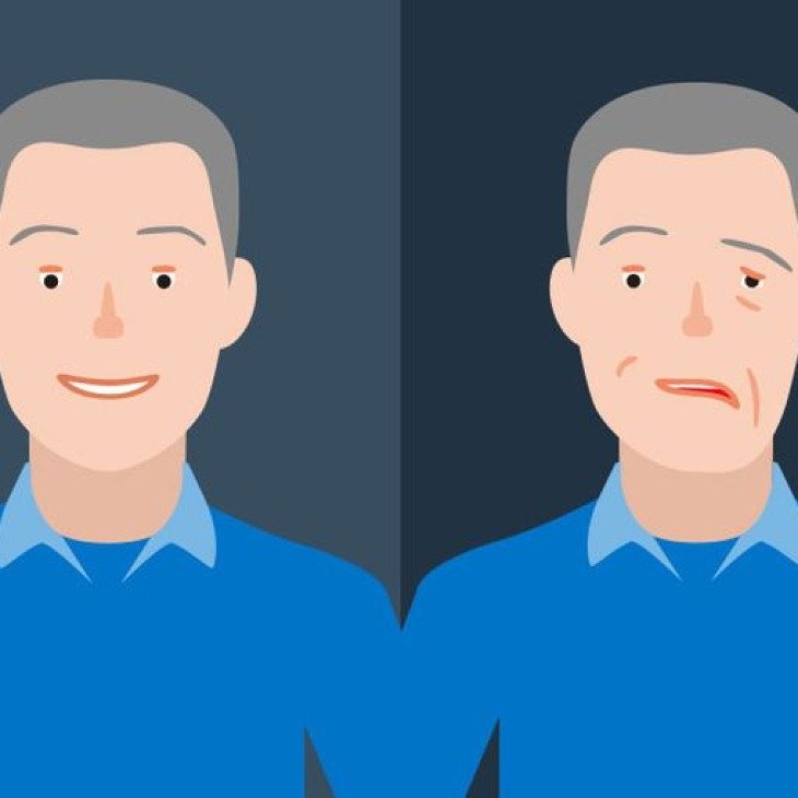 Gambar: Bell's Palsy vs Stroke